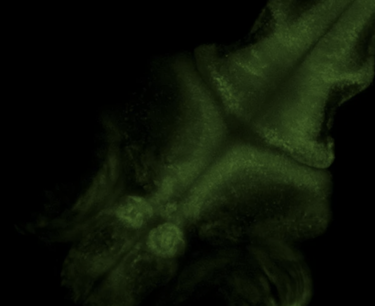 Whole-brain Imaging of Freely-moving Zebrafish